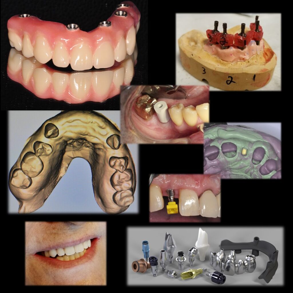 The Ultimate Implant Training For The General Dentist Fall 2024   Prosthetic Module 1024x1024 